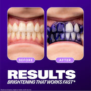 Hismile - V34 Whitening Strips