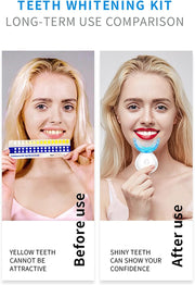 SMILE KIT™ Professional 35% CP Set - Сет за професионално белеење заби