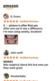 Hismile - V34 Whitening Strips