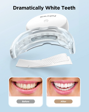 Fairywill Ultra White Ленти за белеење заби + УВ ВООСТ ламба🧬