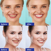 5DWhite Professional Strips - Ленти за белеење заби