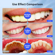 Fairywill Ultra Сет 6х 22% Пероксид Гел +  УВ БООСТ LED СВЕТЛО✨🦷